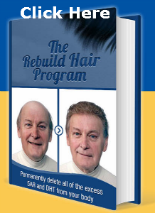 If you've uttered the phrase, 'My hair is falling out,' it's time to look into the Rebuild Hair Program'