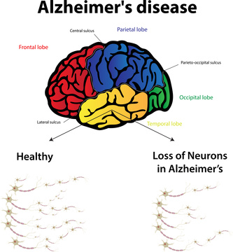 While there is a biological cause of autism, are there any psycho-emotional factors?